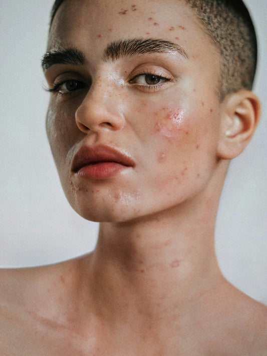 How to Build a Skincare Routine That Actually Works